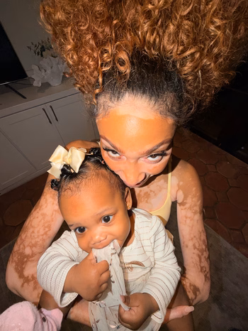 Winnie Harlow - Photo 1